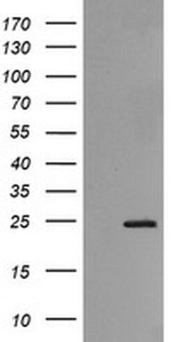 RAB21 Monoclonal Antibody (OTI6A9), TrueMAB , OriGene 100 &mu;L; Unconjugated:Antibodies,