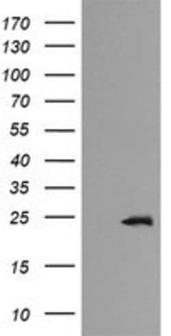 RAB21 Mouse anti-Canine, Human, Mouse, Rat, Clone: OTI6F6, lyophilized,