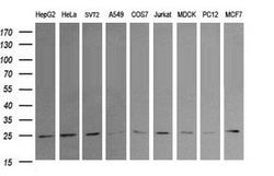RAB21 Mouse anti-Canine, Human, Mouse, Rat, Clone: OTI6F6, lyophilized,
