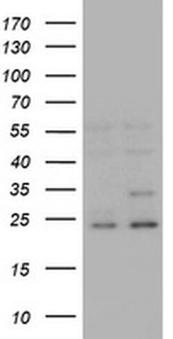 RAB21 Monoclonal Antibody (OTI5B12), TrueMAB , OriGene 100 &mu;L; Unconjugated:Antibodies,