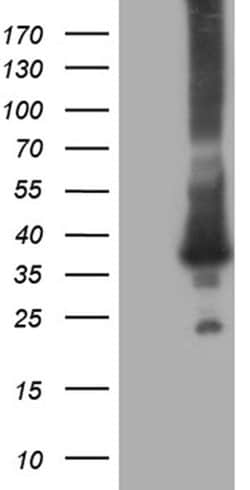 RAB23 Monoclonal Antibody (OTI2F3), TrueMAB , OriGene 100 &mu;L; Unconjugated:Antibodies,