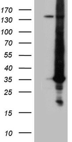 RAB23 Monoclonal Antibody (OTI2A8), TrueMAB , OriGene 100 &mu;L; Unconjugated:Antibodies,