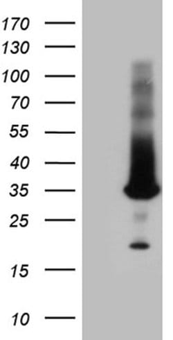 RAB23 Mouse anti-Human, Clone: OTI1A3, lyophilized, TrueMAB 100 &mu;g;