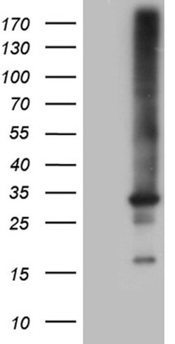 RAB23 Mouse anti-Human, Clone: OTI4C7, lyophilized, TrueMAB 100 &mu;g;