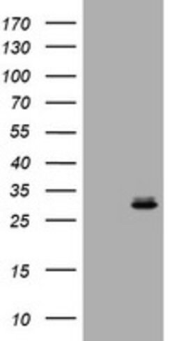 RAB24 Mouse anti-Human, Clone: OTI4H10, lyophilized, TrueMAB 100 &mu;g;