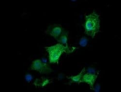 RAB30 Monoclonal Antibody (OTI3B7), TrueMAB , OriGene 30 &mu;L; Unconjugated:Antibodies,