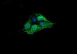 RAB30 Monoclonal Antibody (OTI4B9), TrueMAB , OriGene:Antibodies:Primary