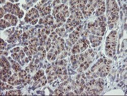 RAB30 Mouse anti-Human, Clone: OTI3C6, lyophilized, TrueMAB 100 &mu;g;