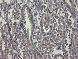 RAB30 Mouse anti-Human, Clone: OTI3C6, lyophilized, TrueMAB 100 &mu;g;