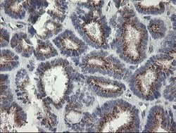 RAB30 Mouse anti-Human, Clone: OTI3C6, lyophilized, TrueMAB 100 &mu;g;