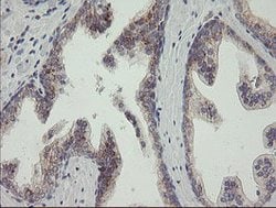 RAB30 Mouse anti-Human, Clone: OTI3C6, lyophilized, TrueMAB 100 &mu;g;