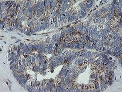 RAB30 Monoclonal Antibody (OTI3E7), TrueMAB , OriGene 100 &mu;L; Unconjugated:Antibodies,