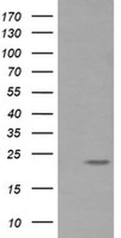 RAB30 Monoclonal Antibody (OTI3B7), TrueMAB , OriGene 30 &mu;L; Unconjugated:Antibodies,