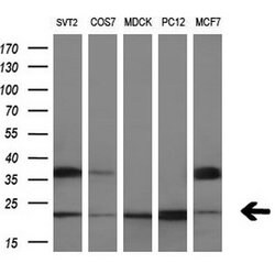 RAB30 Mouse anti-Human, Clone: OTI3C6, lyophilized, TrueMAB 100 &mu;g;