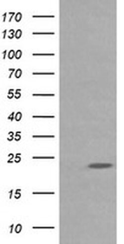 RAB30 Monoclonal Antibody (OTI3F4), TrueMAB , OriGene 100 &mu;L; Unconjugated:Antibodies,