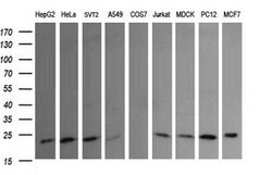 RAB30 Mouse anti-Canine, Human, Mouse, Rat, Clone: OTI3F4, lyophilized,