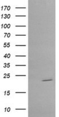 RAB30 Mouse anti-Human, Clone: OTI4B10, lyophilized, TrueMAB 100 &mu;g;