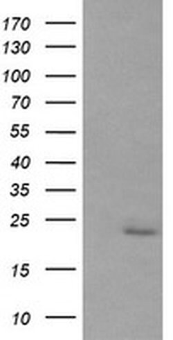 RAB30 Monoclonal Antibody (OTI4B9), TrueMAB , OriGene:Antibodies:Primary