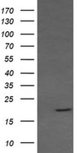 RAB30 Monoclonal Antibody (OTI1D3), TrueMAB , OriGene 100 &mu;L; Unconjugated:Antibodies,