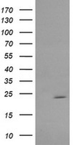 RAB30 Monoclonal Antibody (OTI3B1), TrueMAB , OriGene 30 &mu;L; Unconjugated:Antibodies,