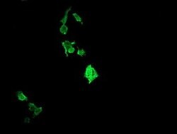 RAB37 Monoclonal Antibody (OTI2F8), TrueMAB , OriGene:Antibodies:Primary
