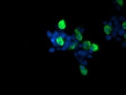 RAB37 Mouse anti-Human, Clone: OTI2D1, lyophilized, TrueMAB 100 &mu;g;