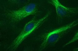 RAB37 Mouse anti-Human, Clone: OTI2D1, lyophilized, TrueMAB 100 &mu;g;