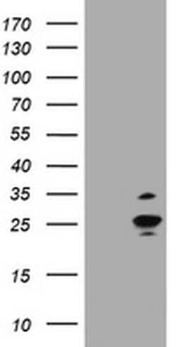 RAB37 Monoclonal Antibody (OTI1G1), TrueMAB , OriGene 100 &mu;L; Unconjugated:Antibodies,