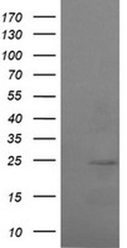 RAB37 Monoclonal Antibody (OTI2F8), TrueMAB , OriGene:Antibodies:Primary