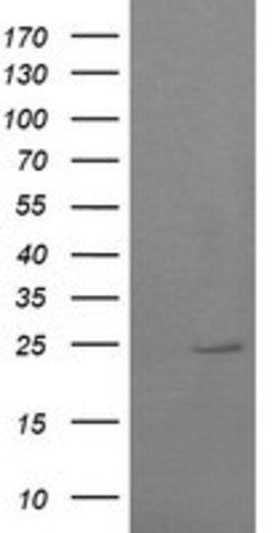 RAB37 Mouse anti-Human, Clone: OTI1E10, lyophilized, TrueMAB 100 &mu;g;