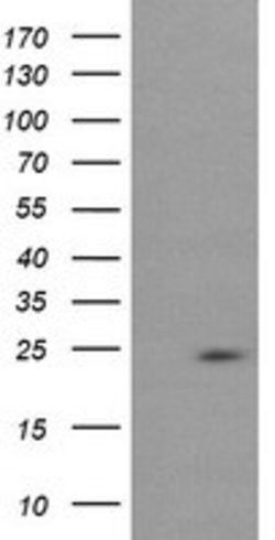 RAB37 Mouse anti-Human, Clone: OTI2D1, lyophilized, TrueMAB 100 &mu;g;