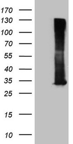 RAB3A Monoclonal Antibody (OTI5C12), TrueMAB , OriGene 100 &mu;L; Unconjugated:Antibodies,