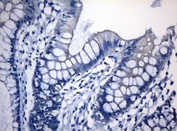 RAB3IP Monoclonal Antibody (OTI5F2), TrueMAB , OriGene 30 &mu;L; Unconjugated:Antibodies,