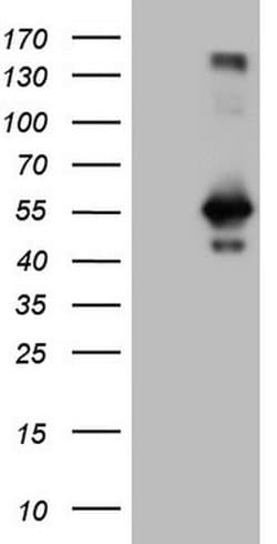 RAB3IP Monoclonal Antibody (OTI5F2), TrueMAB , OriGene 30 &mu;L; Unconjugated:Antibodies,