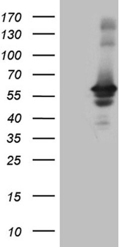RAB3IP Mouse anti-Human, Clone: OTI4A7, lyophilized, TrueMAB 100 &mu;g;