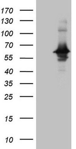RAB3IP Monoclonal Antibody (OTI4B1), TrueMAB , OriGene 100 &mu;L | Buy Online | Origene Technologies | Fisher Scientific