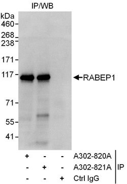 RABEP1 Rabbit anti-Human, Polyclonal, Bethyl Laboratories 10 &mu;L; Unconjugated:Antibodies,