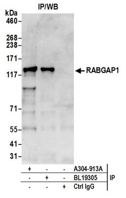 RABGAP1 Rabbit anti-Human, Polyclonal, Bethyl Laboratories 10 &mu;l; Unlabeled:Antibodies,