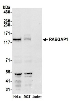 RABGAP1 Rabbit anti-Human, Polyclonal, Bethyl Laboratories 100 &mu;l; Unlabeled:Antibodies,