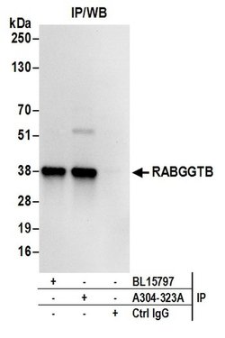 RABGGTB Rabbit anti-Human, Mouse, Polyclonal, Bethyl Laboratories 100 &mu;L;