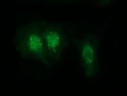RABL2A Monoclonal Antibody (OTI4A8), TrueMAB , OriGene 30 &mu;L; Unconjugated:Antibodies,