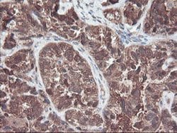 RABL2A Monoclonal Antibody (OTI4A3), TrueMAB , OriGene 100 &mu;L; Unconjugated:Antibodies,