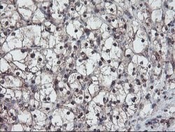 RABL2A Monoclonal Antibody (OTI4A3), TrueMAB , OriGene 100 &mu;L; Unconjugated:Antibodies,
