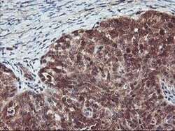 RABL2A Monoclonal Antibody (OTI5A10), TrueMAB , OriGene 30 &mu;L; Unconjugated:Antibodies,