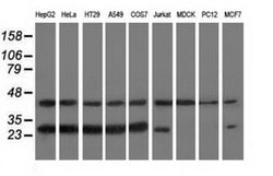 RABL2A Monoclonal Antibody (OTI2G10), TrueMAB , OriGene 30 &mu;L; Unconjugated:Antibodies,