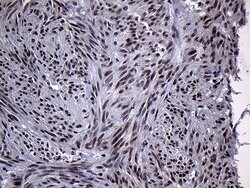 RACGAP1 Monoclonal Antibody (OTI4H8), TrueMAB , OriGene 100 &mu;L; Unconjugated:Antibodies,