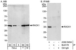 RACK1 Rabbit anti-Human, Mouse, Polyclonal, Bethyl Laboratories 100 &mu;L | Buy Online | Bethyl Laboratories, Inc | Fisher Scientific