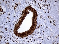 RAD21 Monoclonal Antibody (OTI2A12), TrueMAB , OriGene 100 &mu;L; Unconjugated:Antibodies,