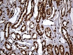 RAD21 Monoclonal Antibody (OTI2A12), TrueMAB , OriGene 100 &mu;L; Unconjugated:Antibodies,