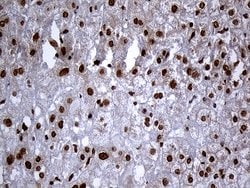 RAD21 Monoclonal Antibody (OTI2A12), TrueMAB , OriGene 100 &mu;L; Unconjugated:Antibodies,